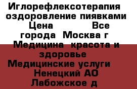 Иглорефлексотерапия, оздоровление пиявками › Цена ­ 3 000 - Все города, Москва г. Медицина, красота и здоровье » Медицинские услуги   . Ненецкий АО,Лабожское д.